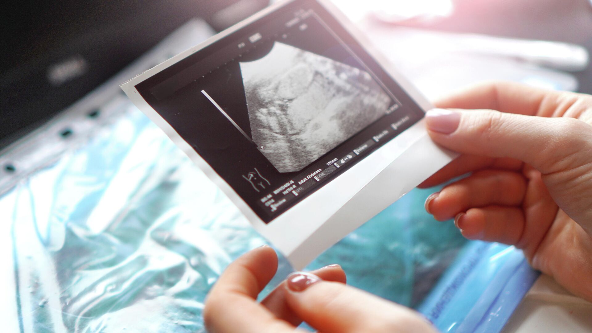 Генетическое тестирование эмбрионов перед имплантацией стало бесплатным по ОМС 1763539938 014431301905 1920x0 80 0 0 81bd849c8ea79651ddc067048b3a039f